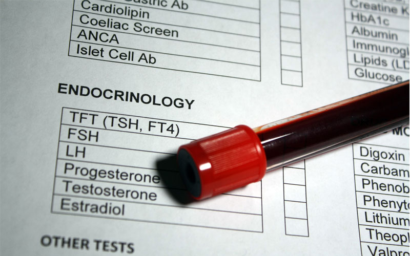 Test for Testosterone Deficiency